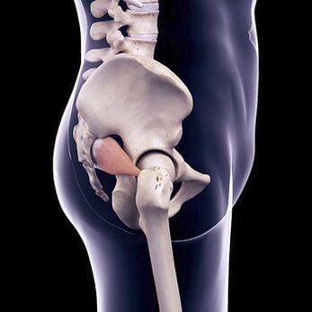 Back pain may be caused by a spasm of the piriformis muscle