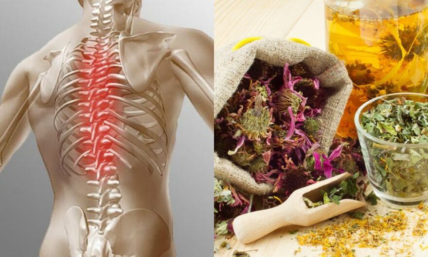 Traditional recipe - prevents the development of osteochondrosis and supports the health of the spine