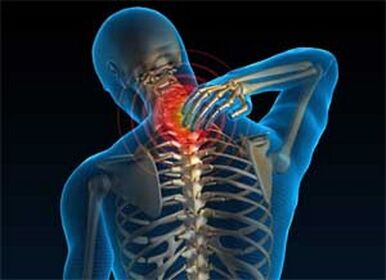 Neck pain is a common symptom of osteochondrosis